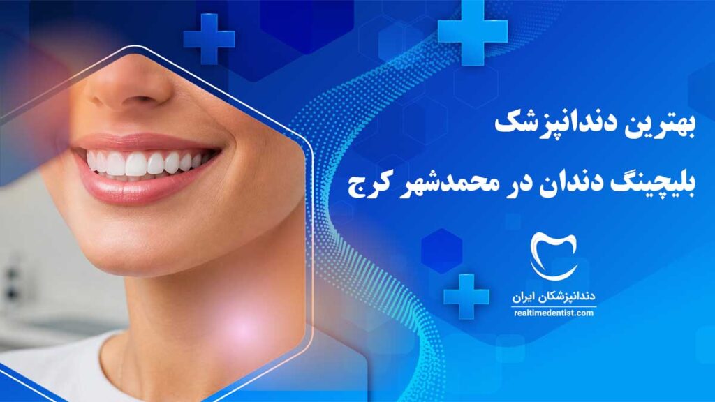 بلیچینگ دندان در محمدشهر کرج