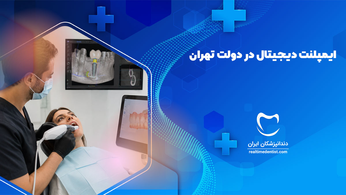 ایمپلنت دیجیتال در دولت تهران