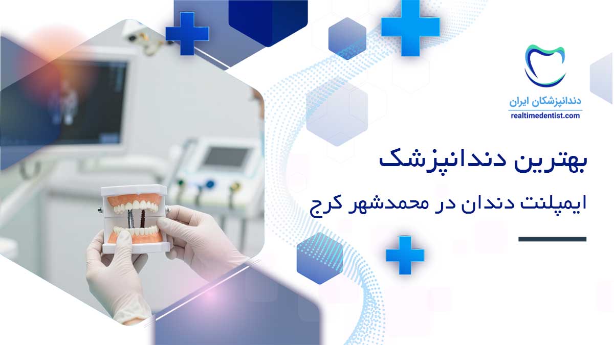 ایمپلنت دندان در محمدشهر کرج