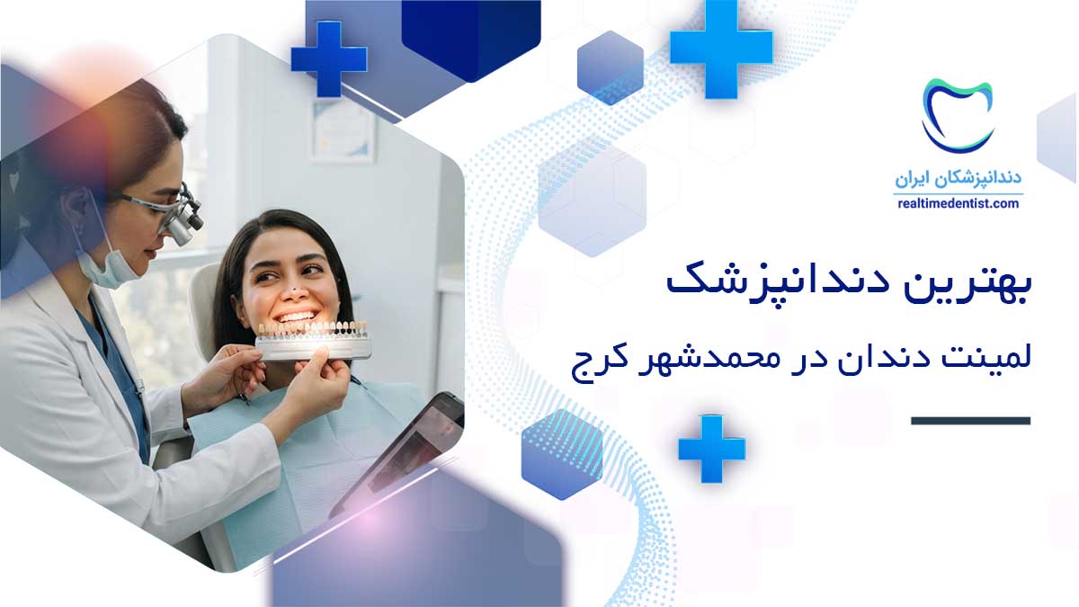 لمینت دندان در محمدشهر کرج