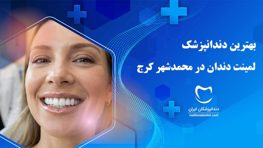 لمینت دندان در محمدشهر کرج