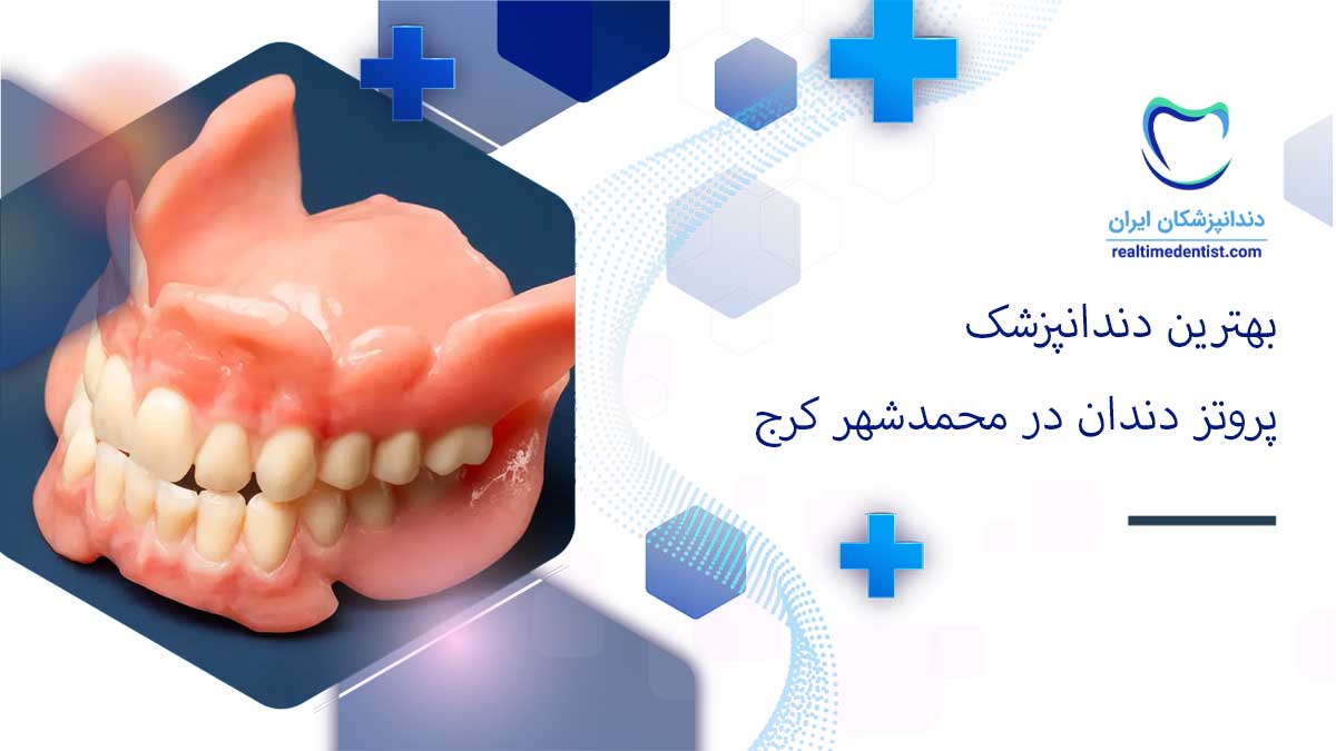 پروتز دندان در محمدشهر کرج