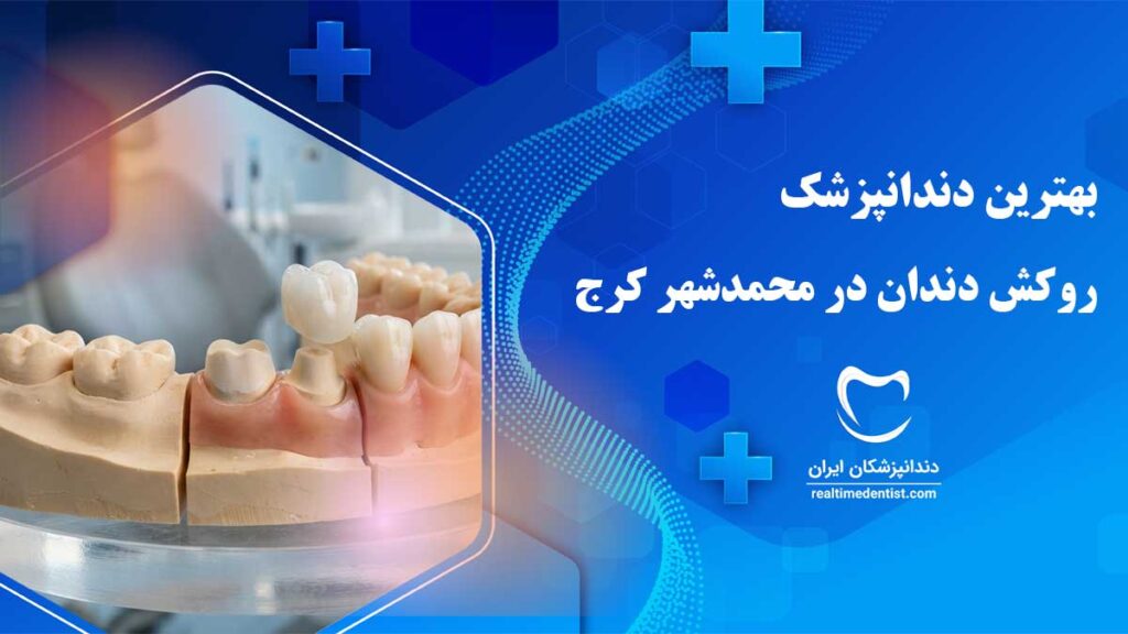 روکش دندان در محمدشهر کرج