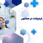 بهترین دکتر ایمپلنت دندان در هفتون اصفهان