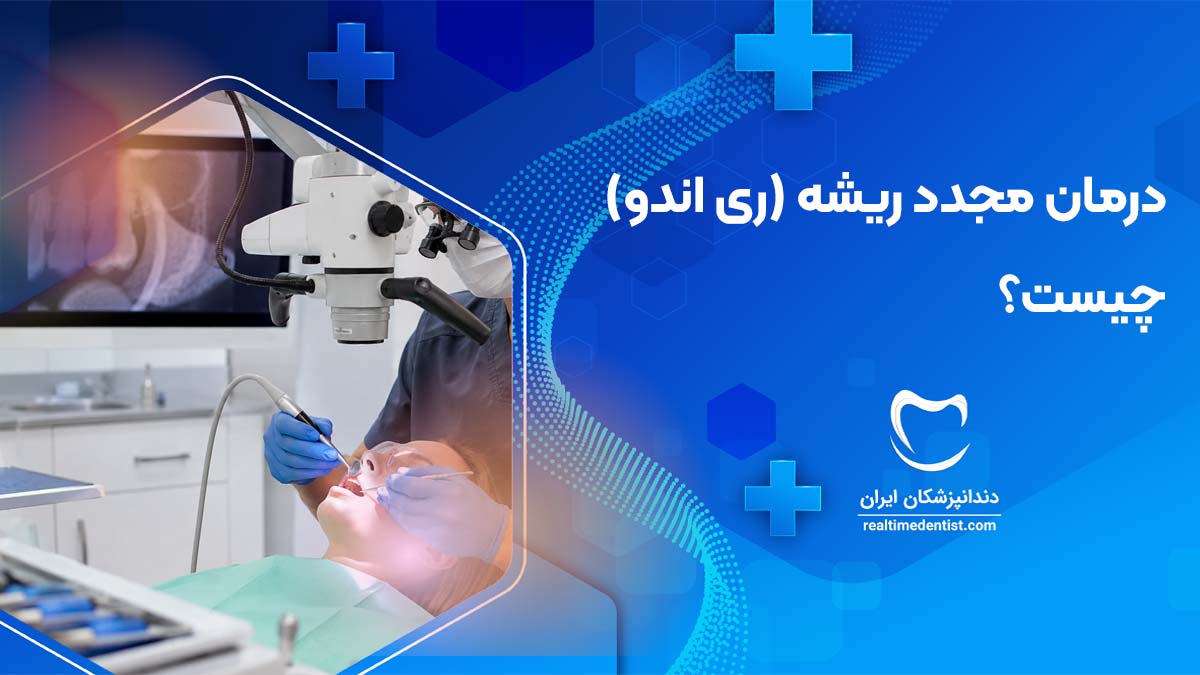 درمان مجدد ریشه (ری اندو) چیست؟ علائم نیاز به عصب کشی مجدد