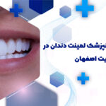 لمینت دندان در خیابان هدایت اصفهان