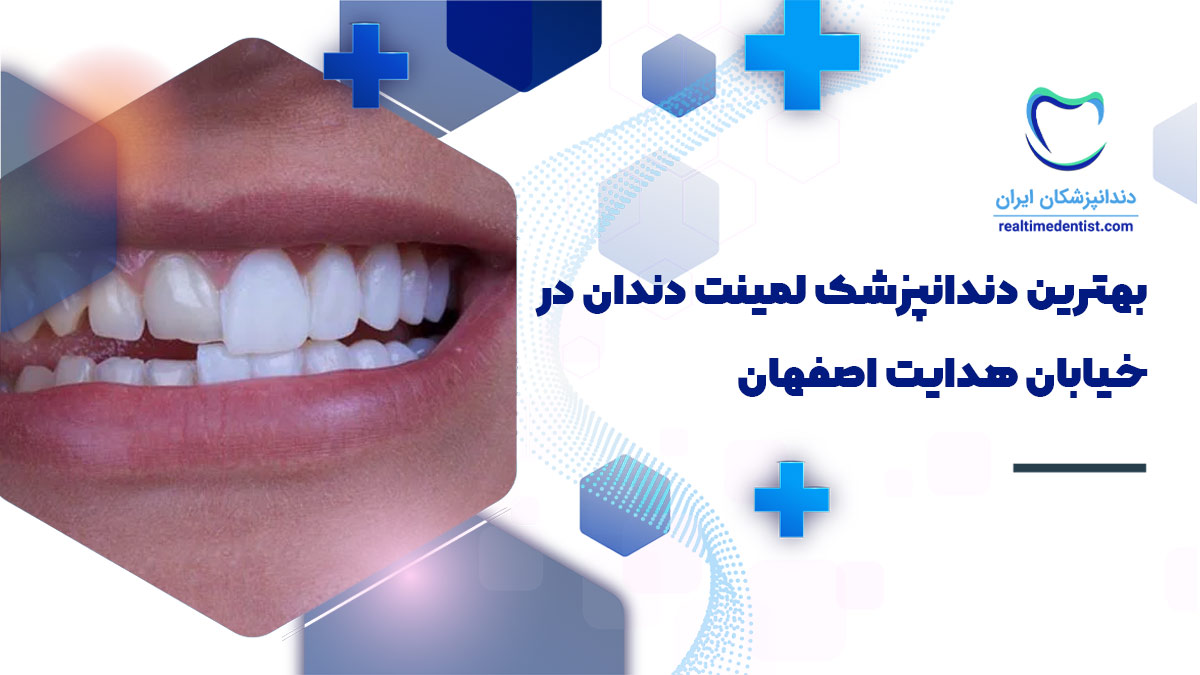 لمینت دندان در خیابان هدایت اصفهان
