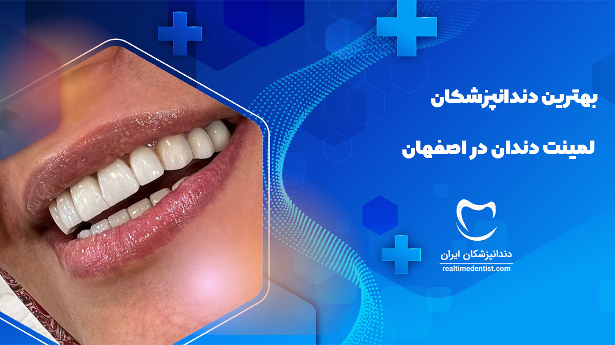 دندانپزشک لمینت دندان در خیابان هدایت اصفهان