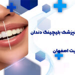 بهترین دندانپزشک بلیچینگ دندان در هدایت اصفهان