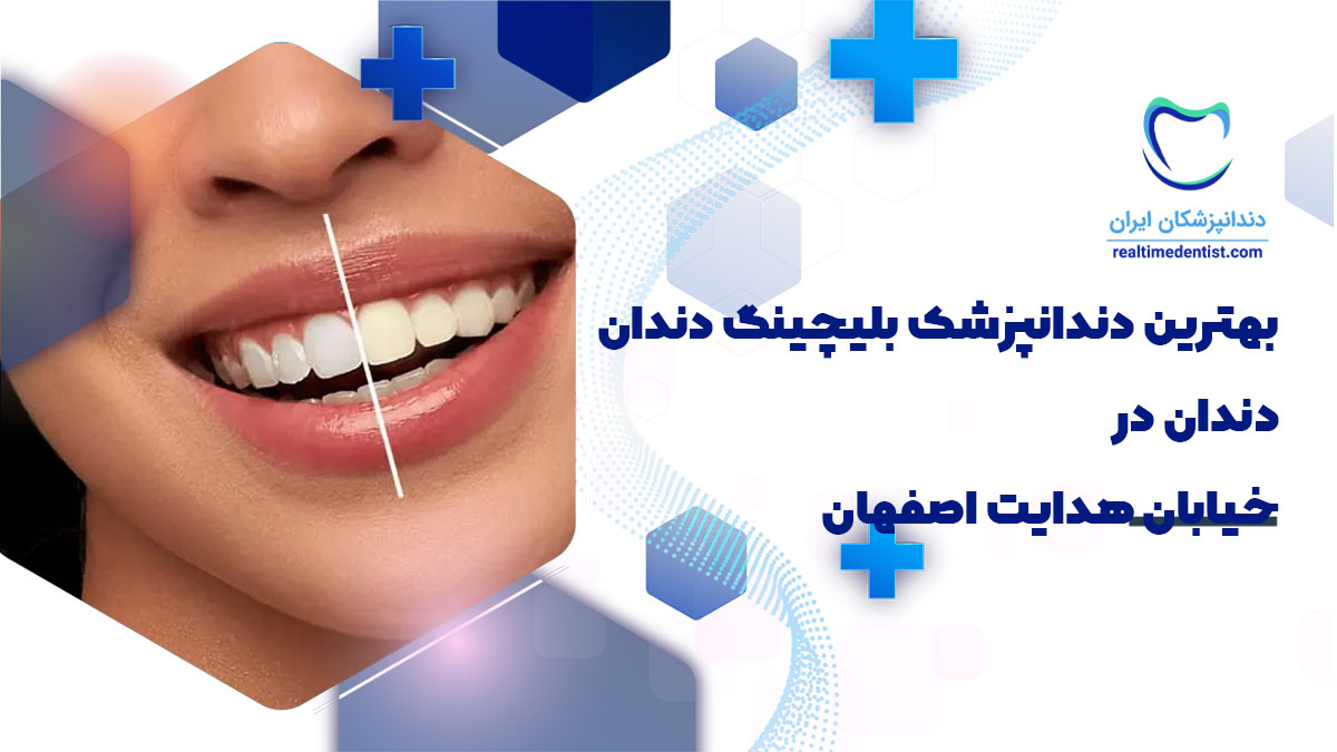 بهترین دندانپزشک بلیچینگ دندان در هدایت اصفهان