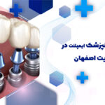 ایمپلنت دندان در هدایت اصفهان