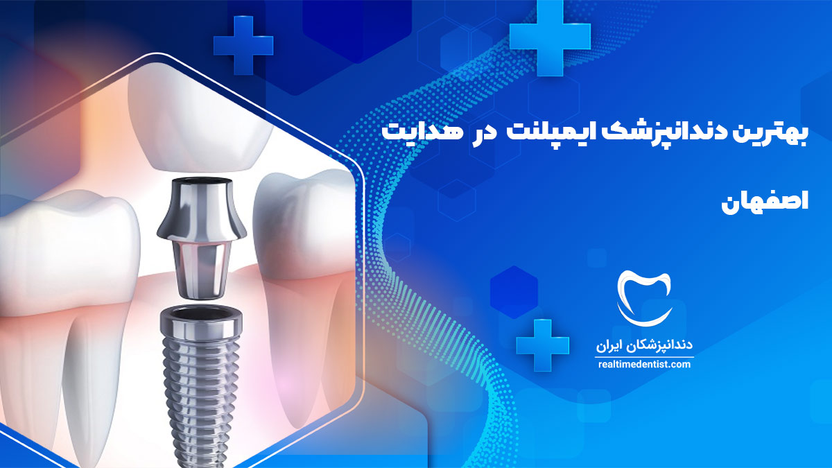  ایمپلنت دندان در هدایت اصفهان