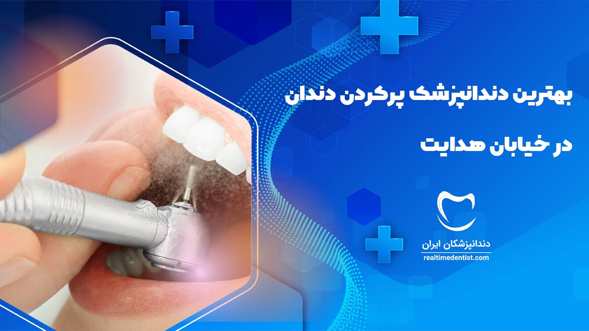 پرکردن دندان در خیابان هدایت اصفهان