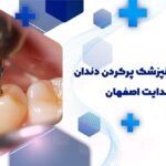 پرکردن دندان در خیابان هدایت اصفهان