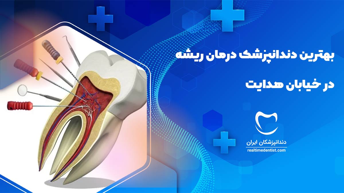درمان ریشه در خیابان هدایت اصفهان