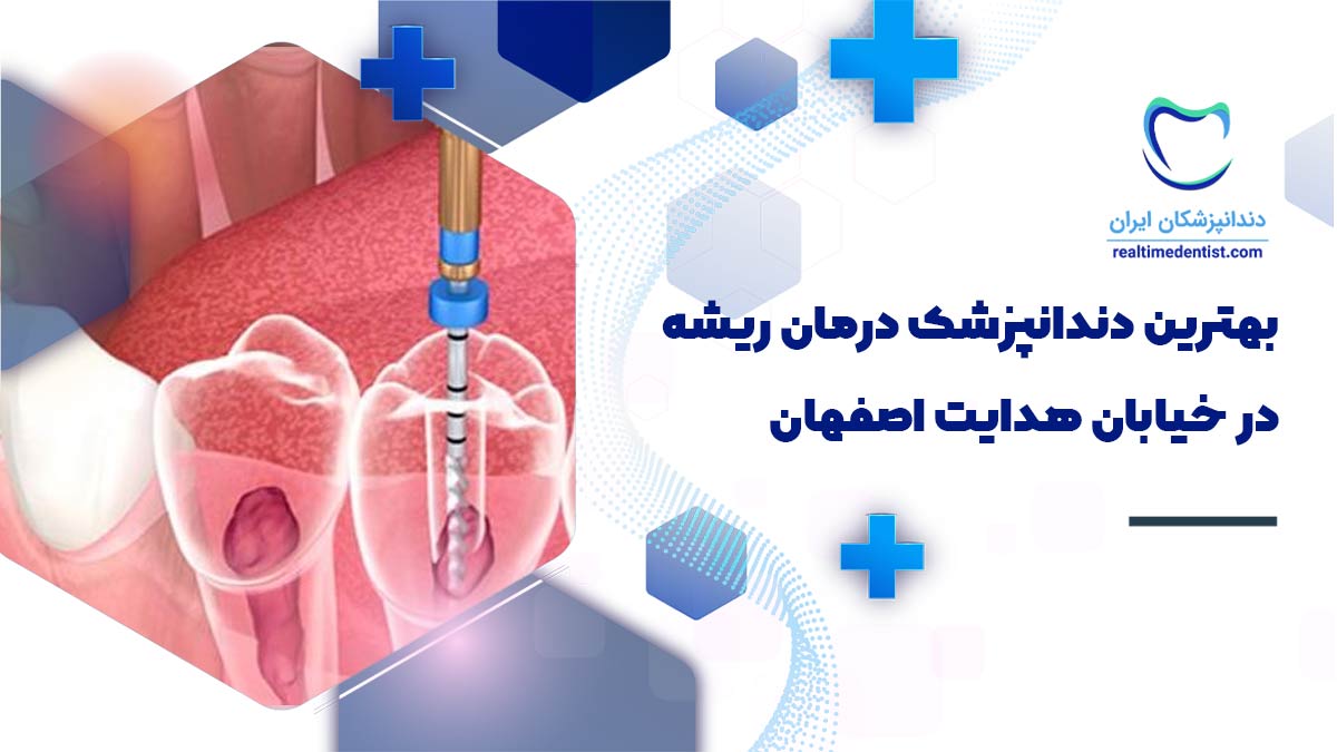 درمان ریشه در خیابان هدایت اصفهان