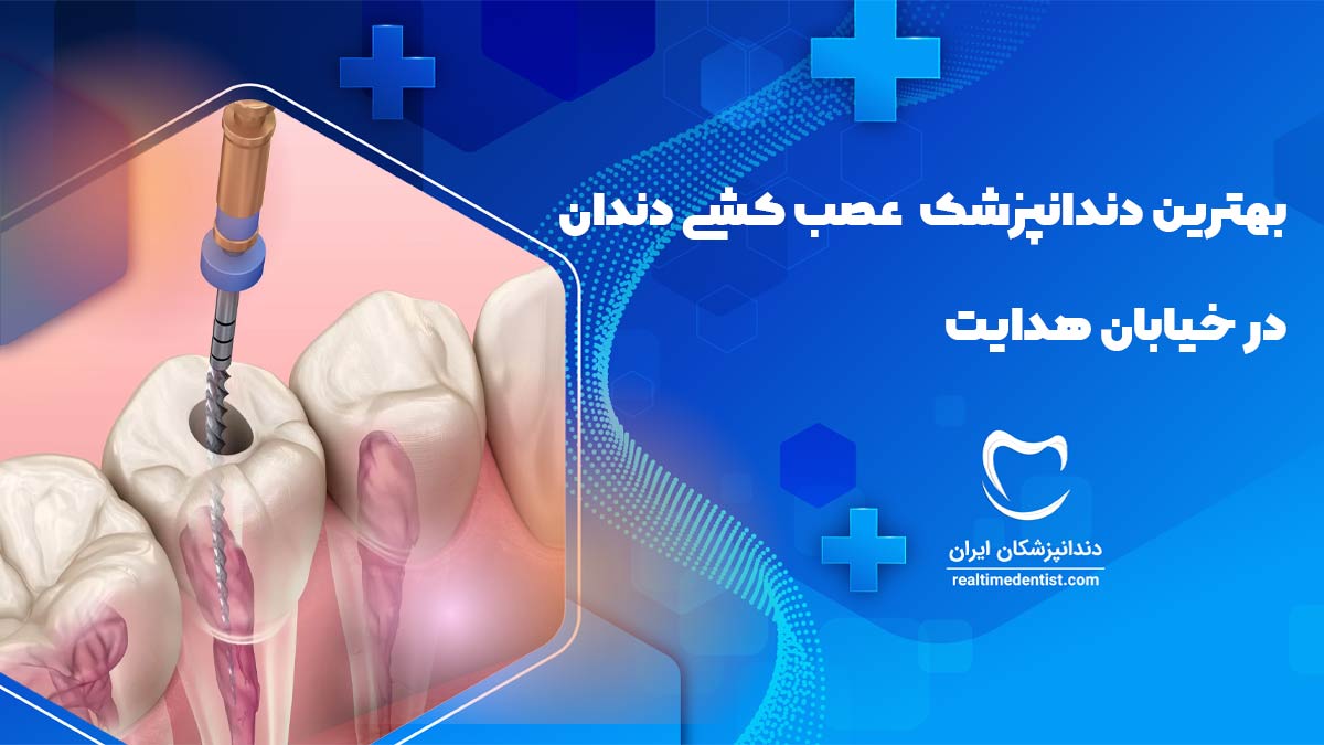 عصب کشی دندان در خیابان هدایت اصفهان