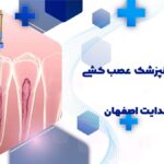 عصب کشی دندان در خیابان هدایت اصفهان