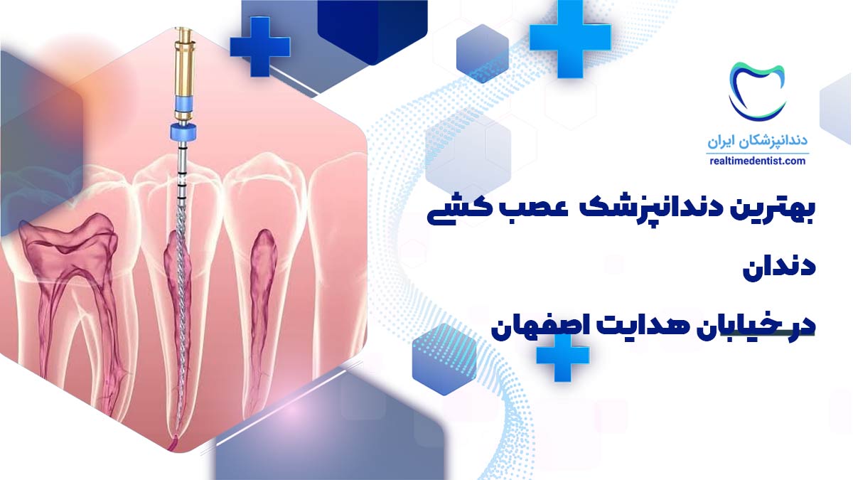 عصب کشی دندان در خیابان هدایت اصفهان