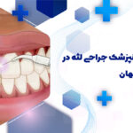دندانپزشک جراحی لثه در هدایت اصفهان