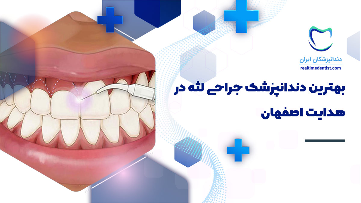 دندانپزشک جراحی لثه در هدایت اصفهان