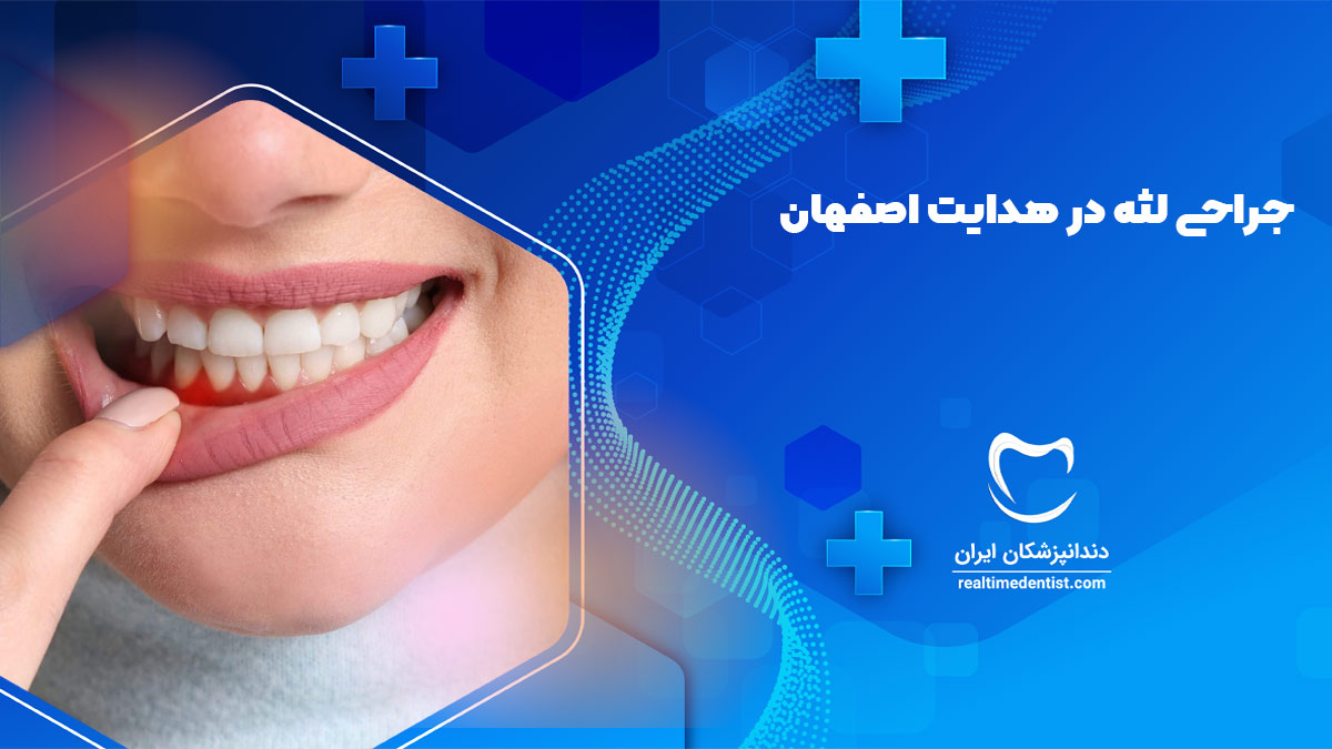 دندانپزشک جراحی لثه در هدایت اصفهان
