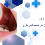 پر کردن دندان در محمدشهر کرج