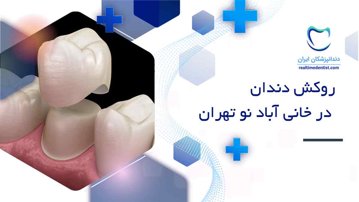 بهترین دندانپزشک روکش دندان در خانی آباد نو تهران