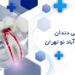 دندانپزشک عصب کشی دندان در خانی آباد نو تهران