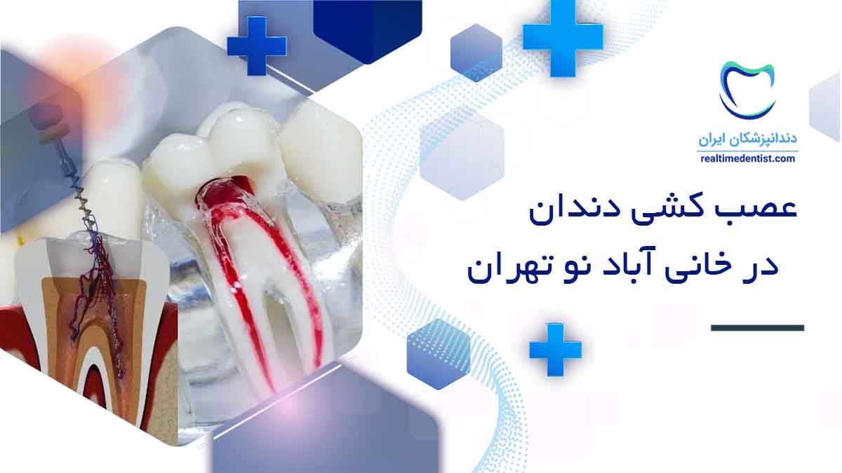 دندانپزشک عصب کشی دندان در خانی آباد نو تهران