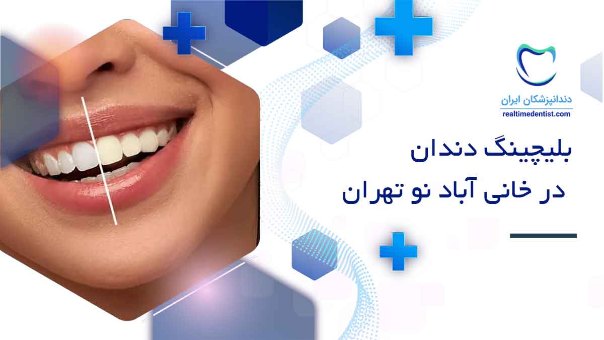 بلیچینگ دندان در خانی آباد نو تهران