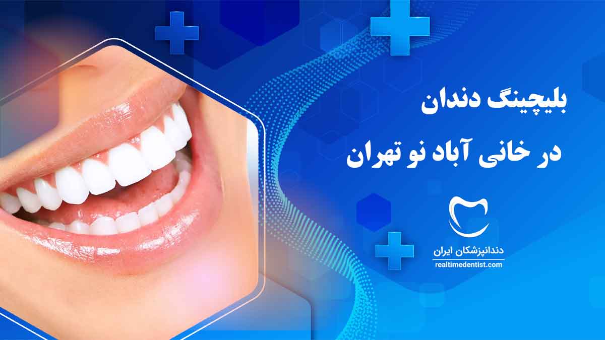 بهترین دندانپزشک بلیچینگ دندان در خانی آباد نو تهران
