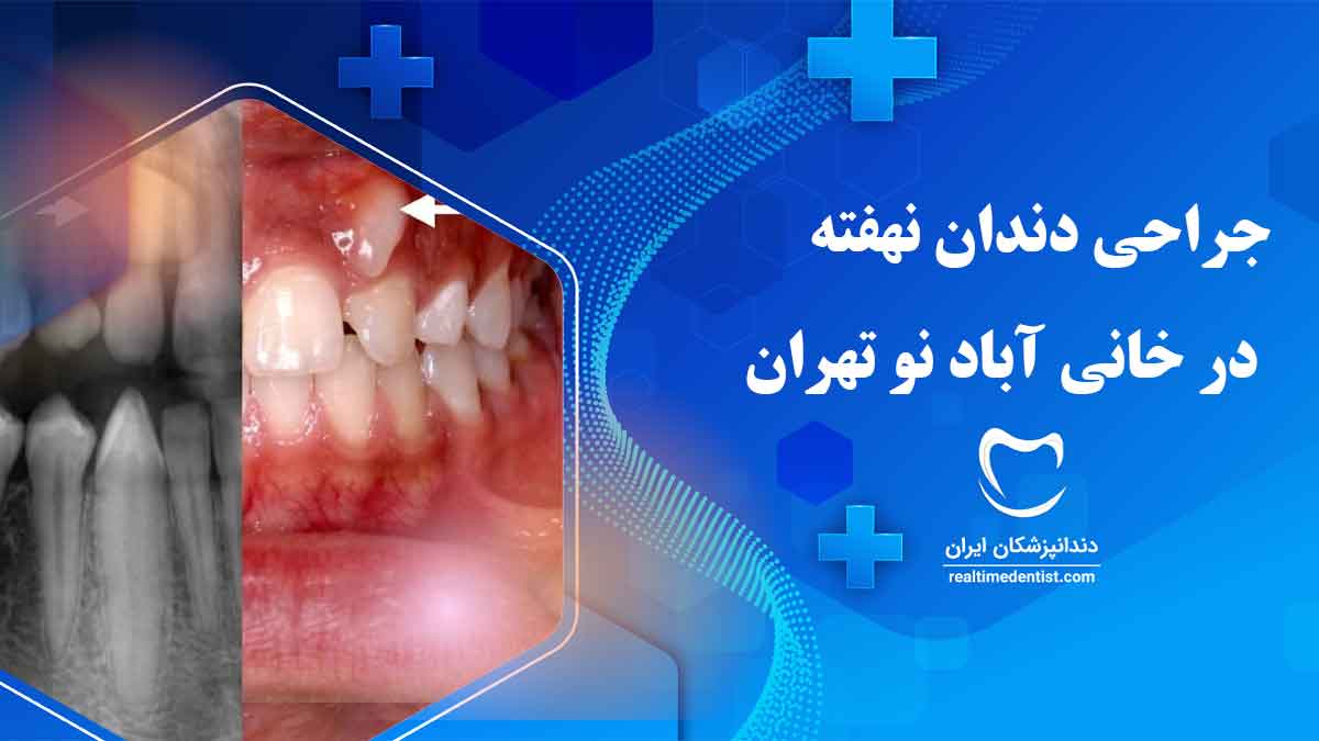 جراحی دندان نهفته در خانی آباد نو تهران