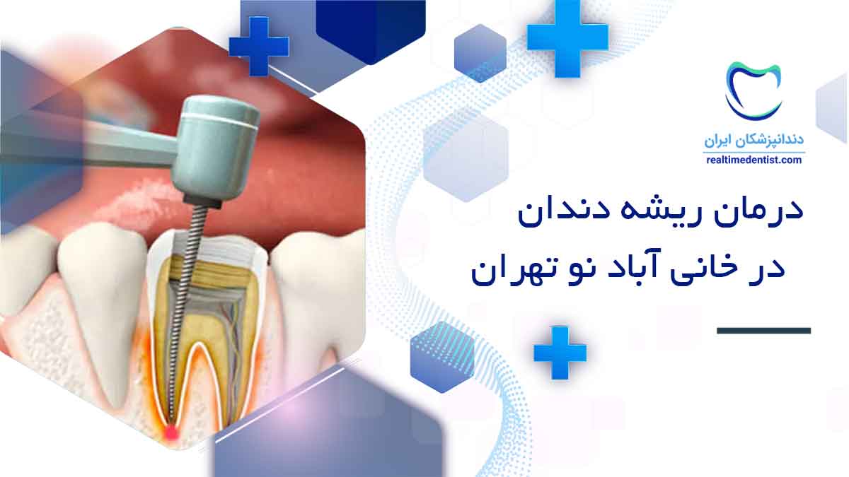 درمان ریشه دندان در خانی آباد نو تهران