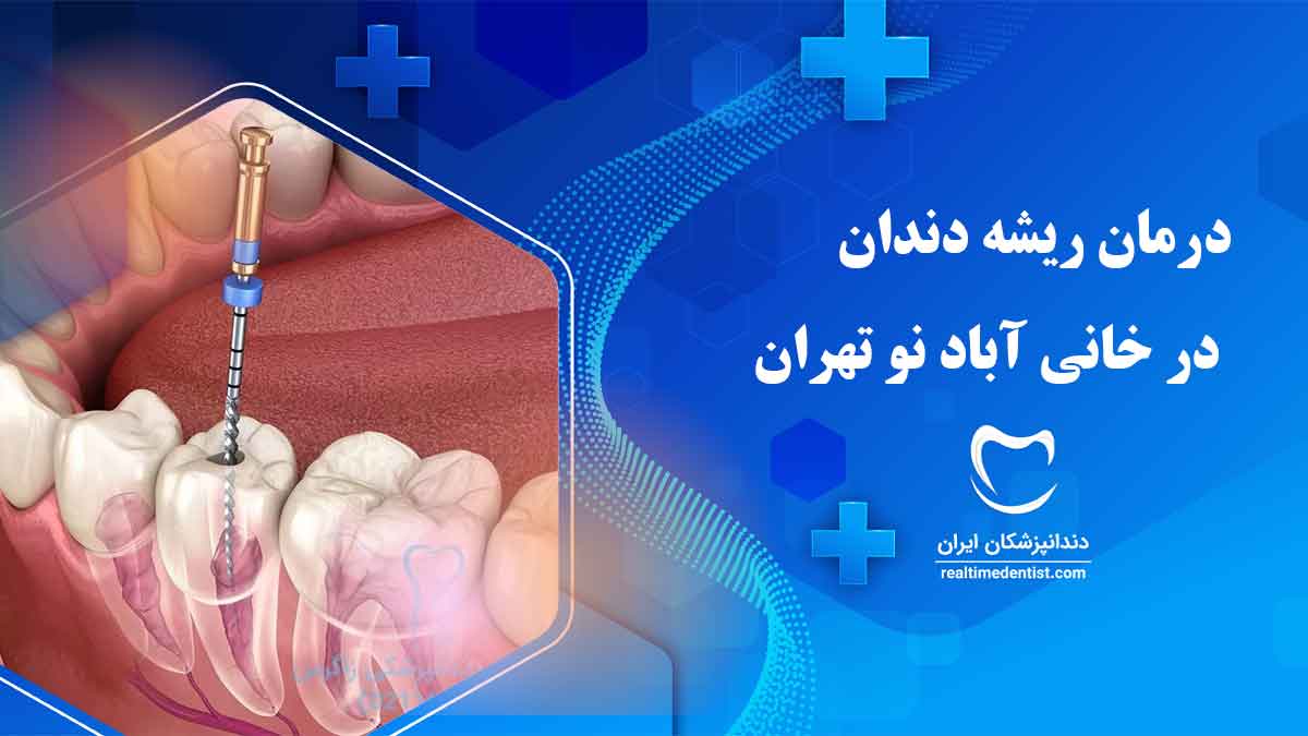بهترین دندانپزشک درمان ریشه دندان در خانی آباد نو تهران