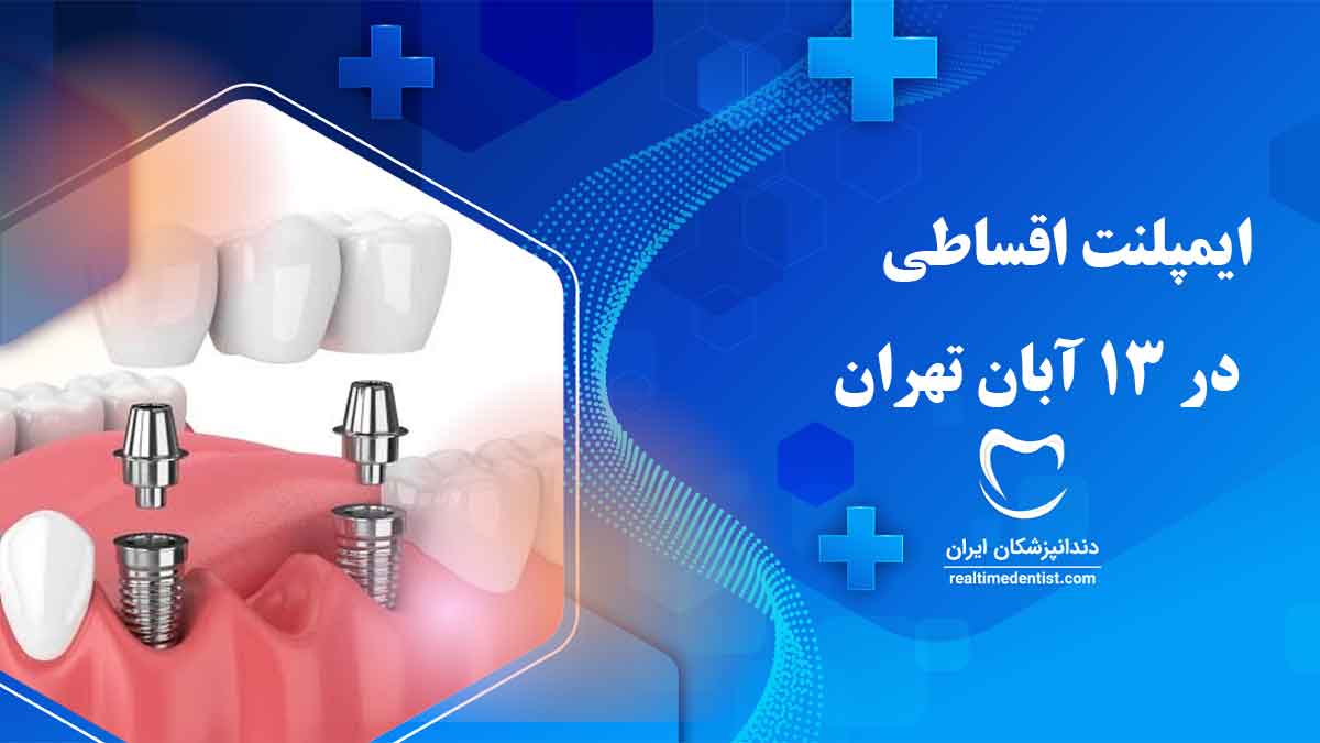 ایمپلنت اقساطی در 13 آبان تهران
