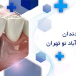 ایمپلنت دندان در خانی آباد نو تهران