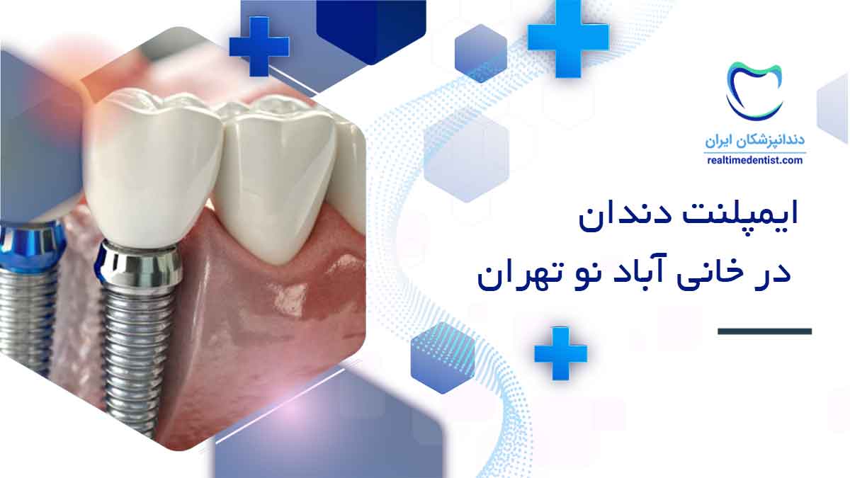 ایمپلنت دندان در خانی آباد نو تهران