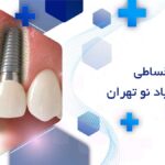 ایمپلنت اقساطی در خانی آباد نو تهران