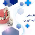 دندانپزشک متخصص ایمپلنت اقساطی در علی آباد تهران