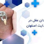 جراحی دندان عقل در خیابان هدایت اصفهان
