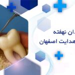 جراحی دندان نهفته در خیابان هدایت اصفهان