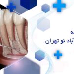 بهترین دندانپزشک جراحی لثه در خانی آباد نو تهران