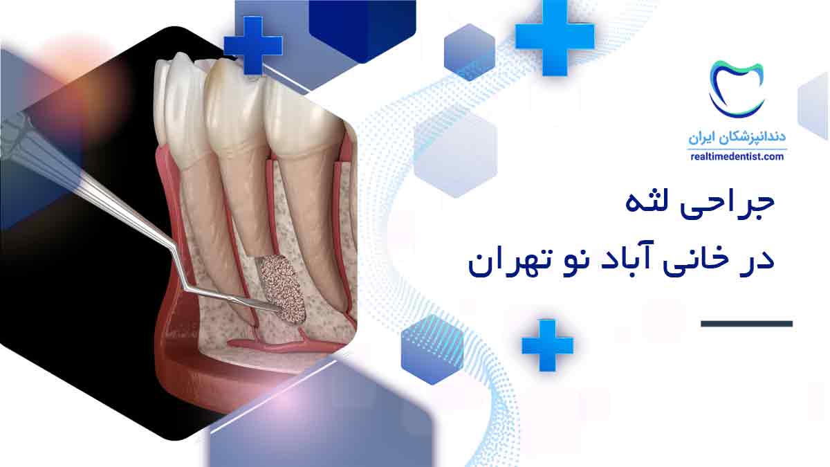 بهترین دندانپزشک جراحی لثه در خانی آباد نو تهران