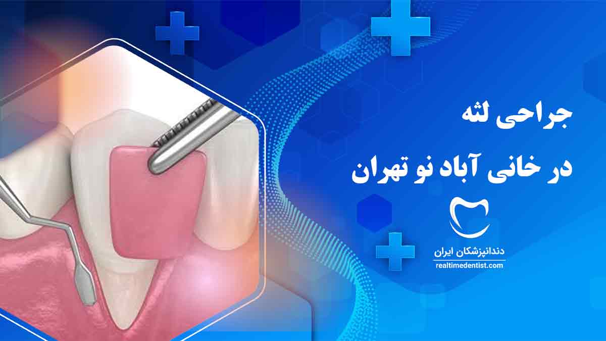 جراحی لثه در خانی آباد نو تهران