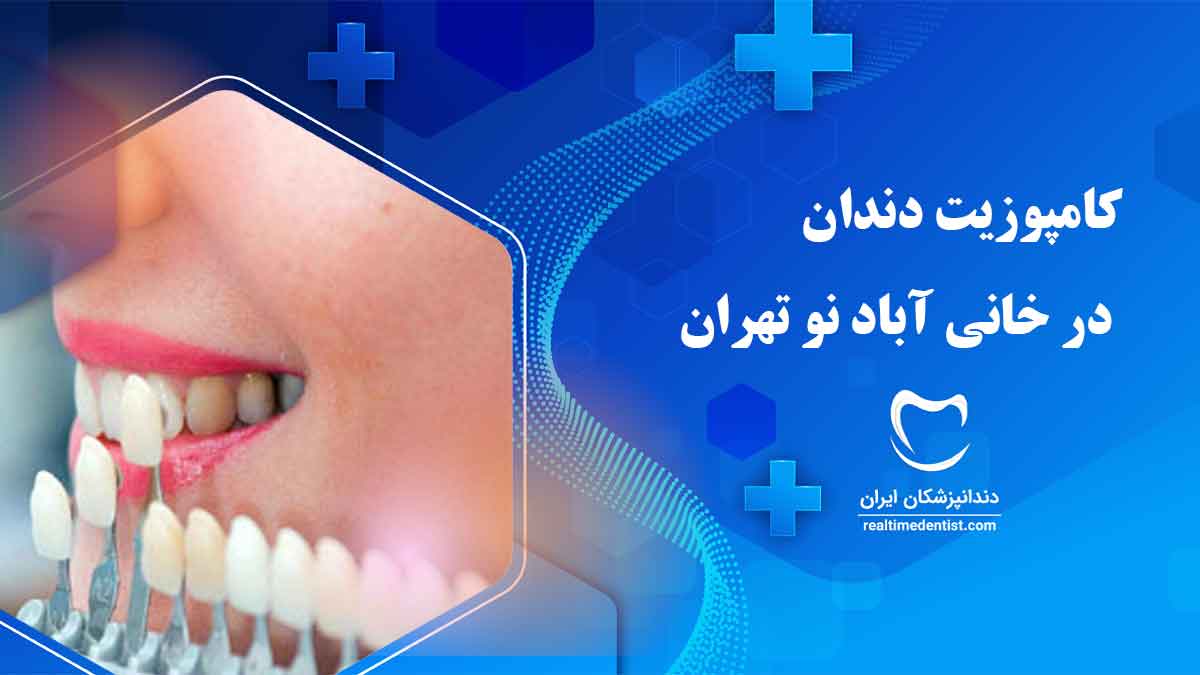 کامپوزیت دندان در خانی آباد نو تهران