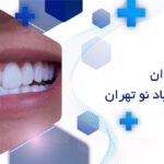 لمینت دندان در خانی آباد نو تهران