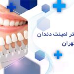 بهترین دکتر لمینت دندان در شمال تهران