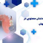 دندانپزشک دندان مصنوعی در هفتون اصفهان