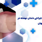 دندانپزشک جراحی دندان نهفته در هفتون اصفهان